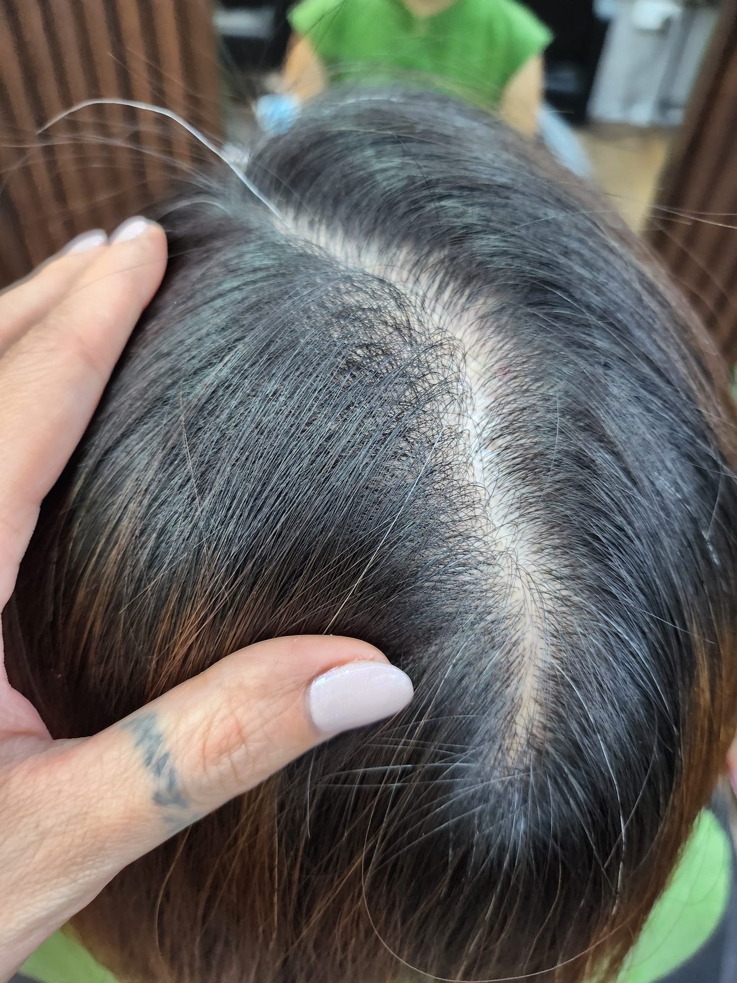 BENEFITS OF SCALP TREATMENTS - Forest Salon|hair and beauty salon bedok